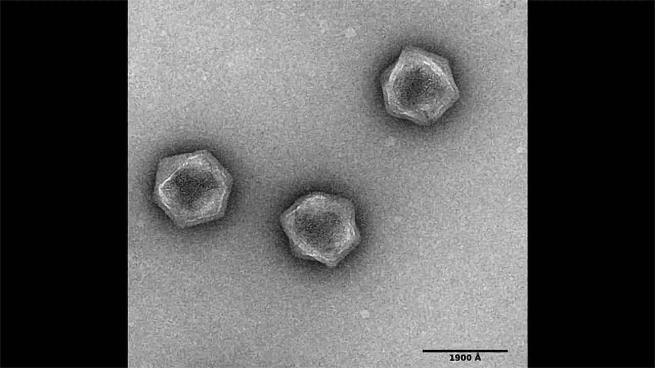 Viruses Don't Have a Metabolism, But Some Have the Foundations for One
