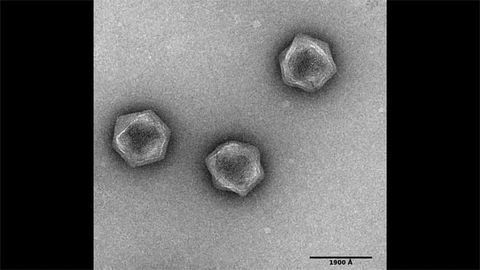 Viruses Don't Have a Metabolism, But Some Have the Foundations for One