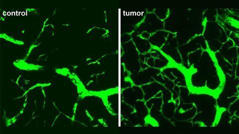 A Potential Drug Target To Slow Lymphoma Tumor Growth