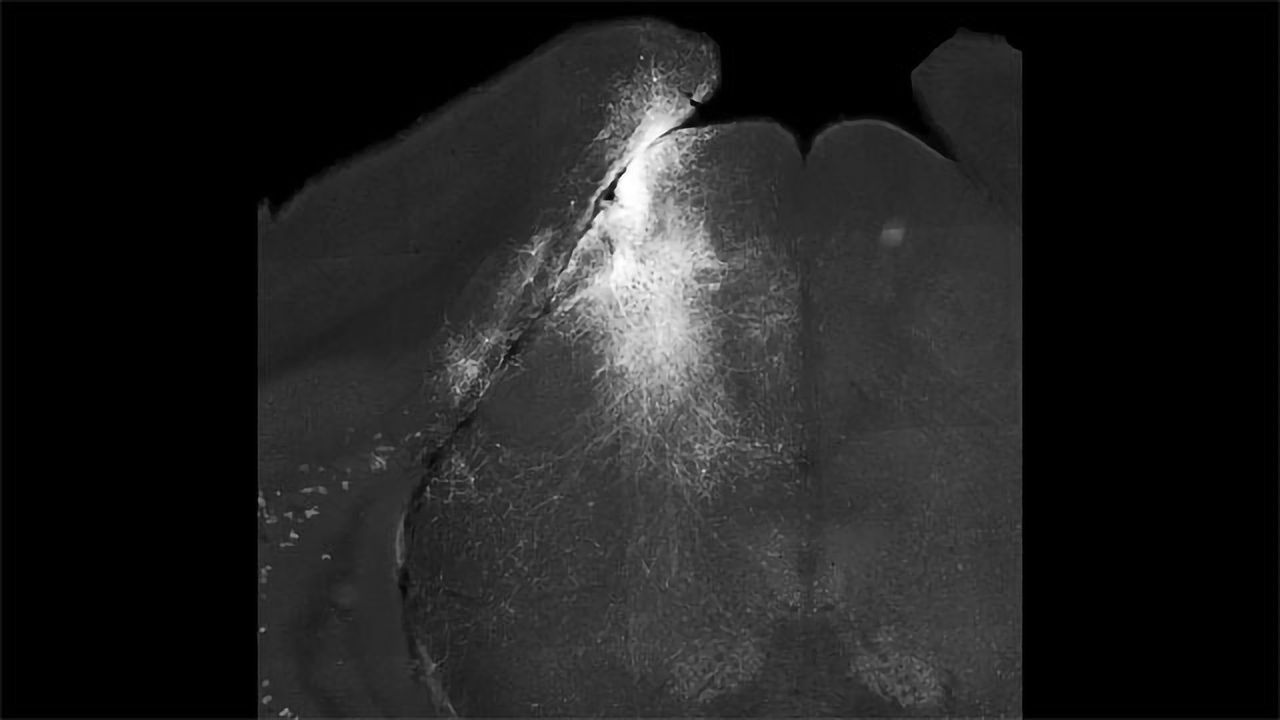 Blocking the Mouse Brain for 100 Milliseconds Means Visual Events Go Unnoticed