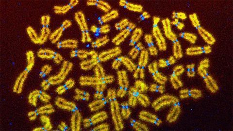 Mitotic Chromosomes