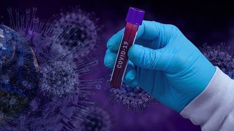 Researchers Determine Structure of SARS-CoV-2 Main Protease and Identify Inhibitors