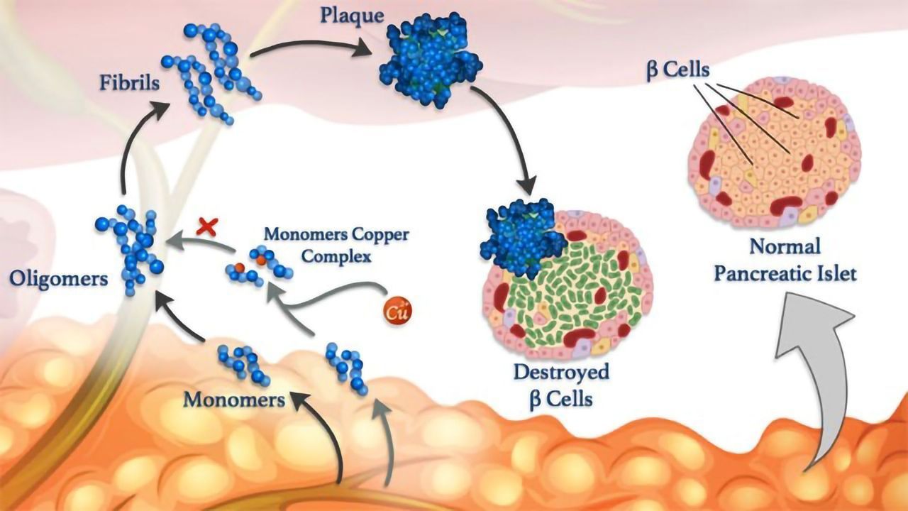 Unraveling Interactions To Understand Disease