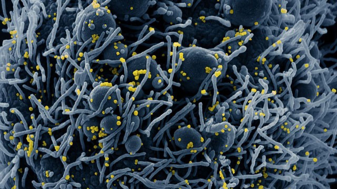 Work Begins To Quantify Undetected Cases of Coronavirus
