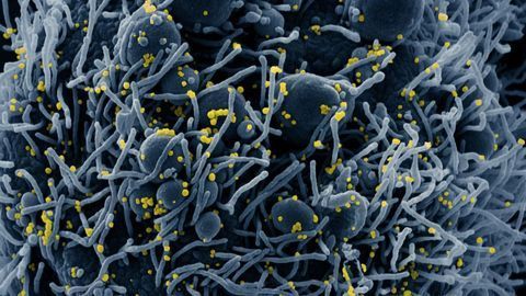 Work Begins To Quantify Undetected Cases of Coronavirus