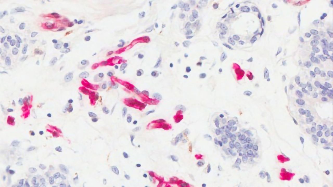 Exploring the Possible Mechanism Linking Obesity and Breast Cancer