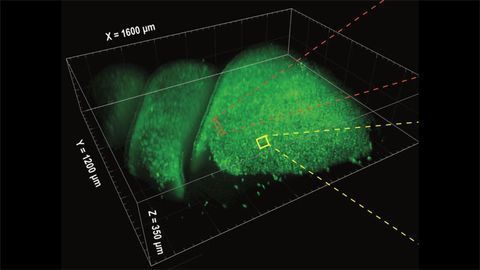 SCAPE Microscope Lets Researchers Watch the Brain Smell in Real Time