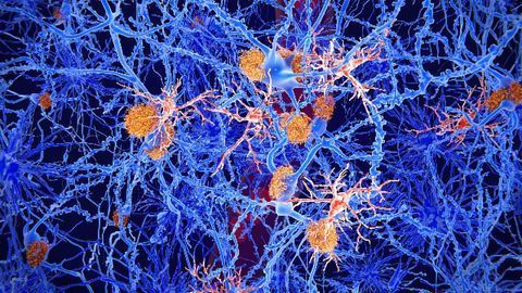 Brain Injury-suppressing Drug Passes Human Safety Testing