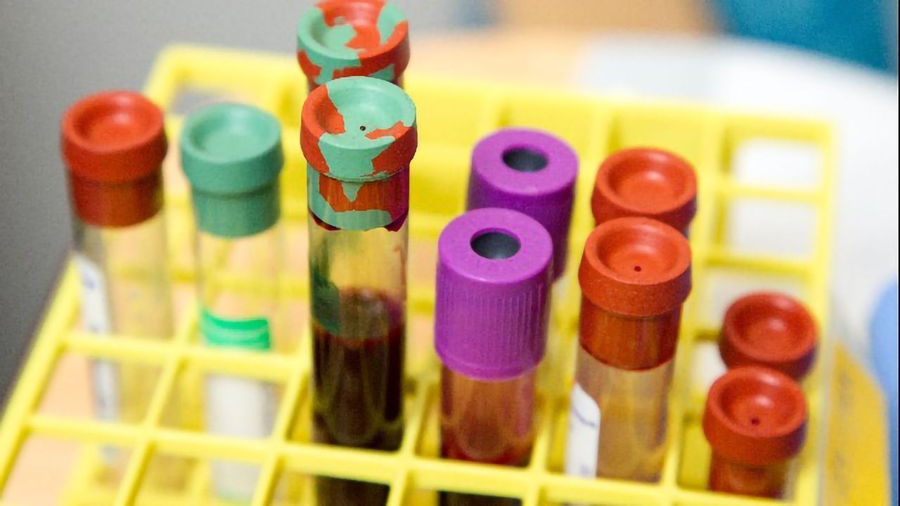 COVID-19 Patient Receives First Transfusion of Plasma From Recovered Patient