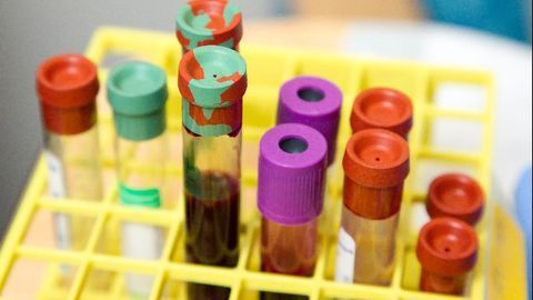 COVID-19 Patient Receives First Transfusion of Plasma From Recovered Patient