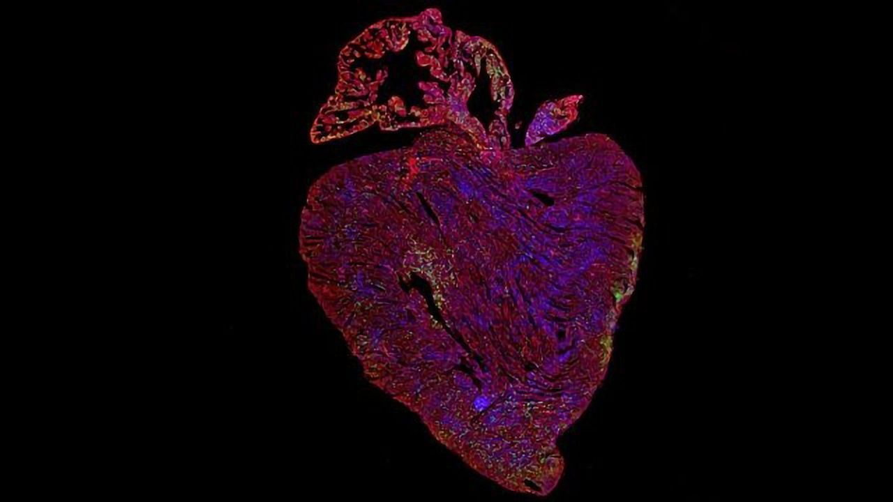Activating Key Cancer Gene Could Provide First Curative Treatment for Heart Disease
