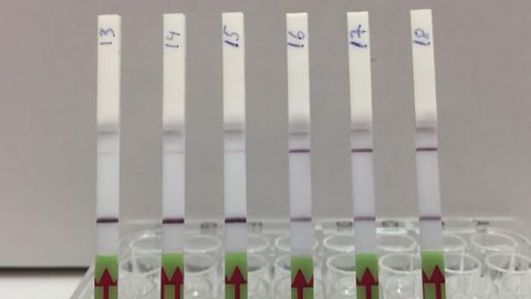 New CRISPR Diagnostic Test for Kidney Transplant Patients