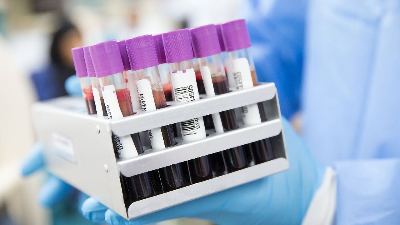 USA’s Largest Serological Testing Study for COVID-19 Antibodies Launched