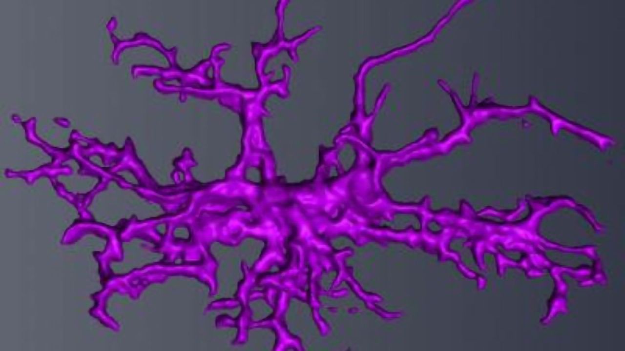 Immune Cell Defects in the Brain Linked to Male Autism