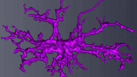 Immune Cell Defects in the Brain Linked to Male Autism