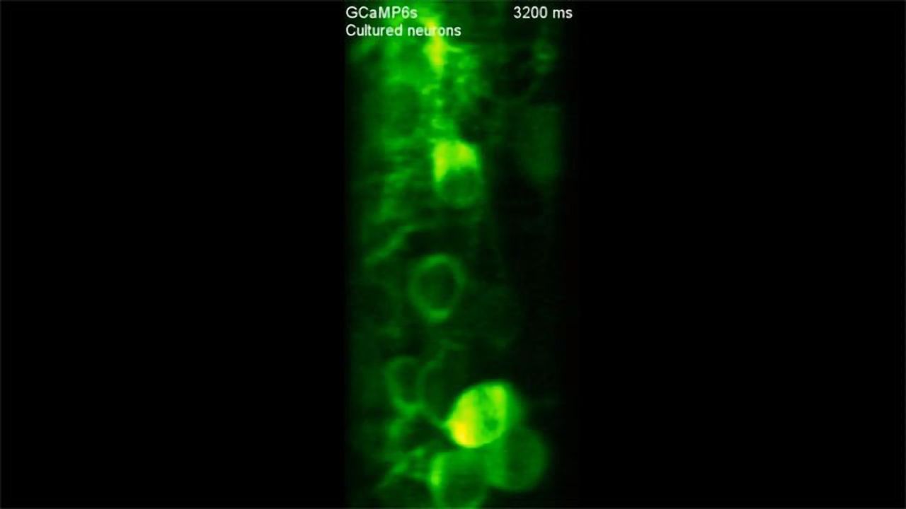 High-speed Microscope Images Neuroactivity