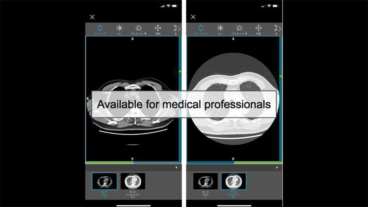 Allm Provides Diagnostic Data Set to Support the Fight Against COVID-19