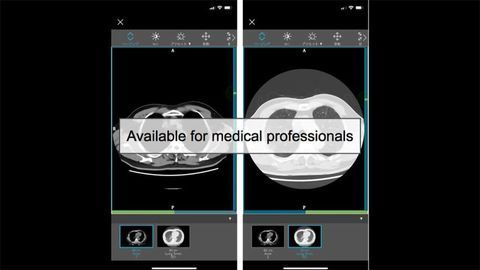 Allm Provides Diagnostic Data Set to Support the Fight Against COVID-19