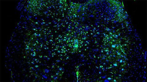 Blood Pressure Medication Solves Spasticity in Mice With Spinal Cord Injuries