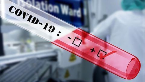 A Call for Mass COVID-19 Testing in Cancer Care