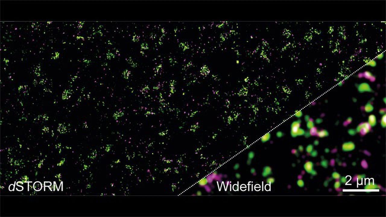 Glutamate Study Gives New Insight on Synapses