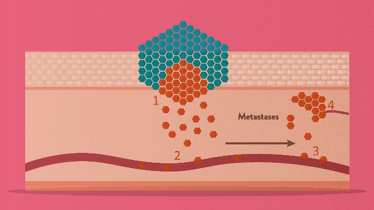 Circulating Tumor Cells: Detection and Applications