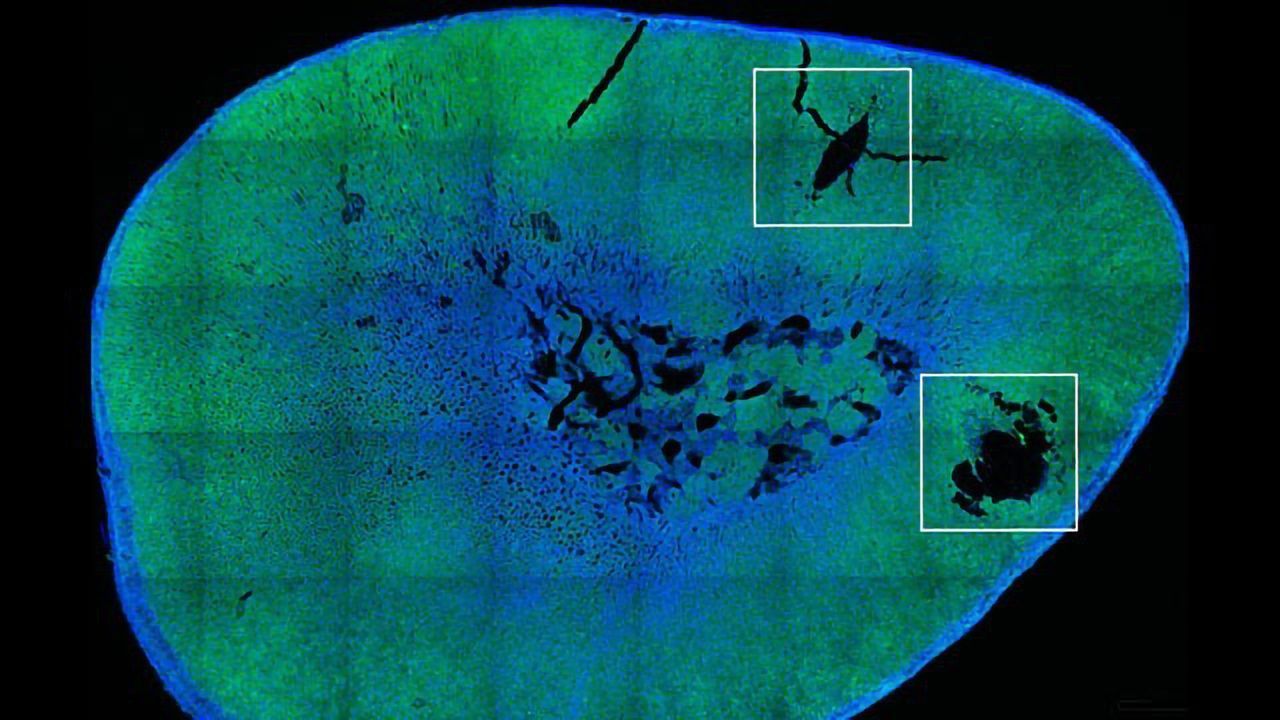 Magnetic Nanoparticles Can Trigger Hormone Release Using Remote Control
