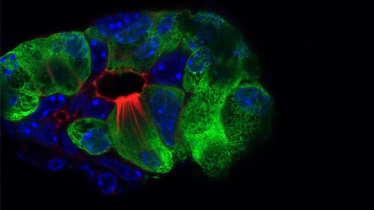 Tuft Cells Found to Play a Part in Pancreatitis