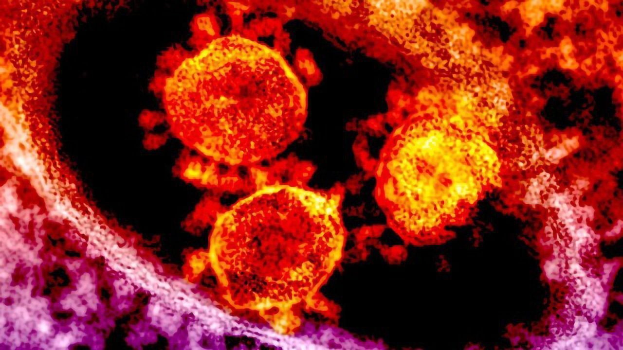 Preprint Suggests MERS-CoV Vaccine Can Protect Monkeys