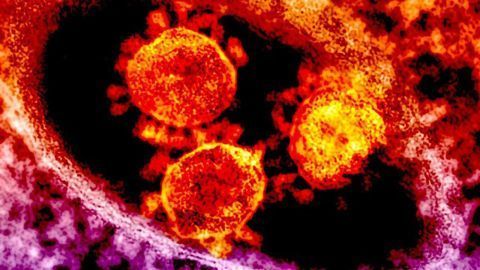 Preprint Suggests MERS-CoV Vaccine Can Protect Monkeys