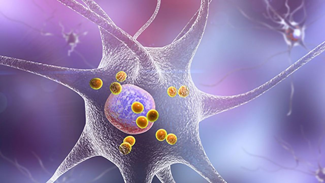A Role for Autoimmunity in Parkinson's Disease?
