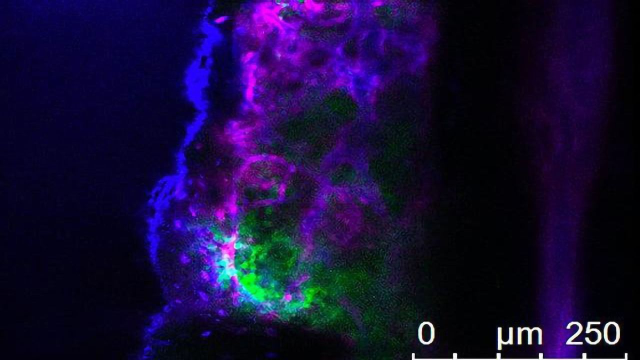 Genome-wide CRISPR Technology Hunts for Leukemia’s Weakness