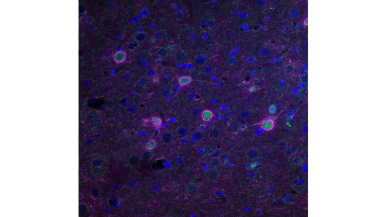 ALS Onset Successfully Delayed in Mouse Model