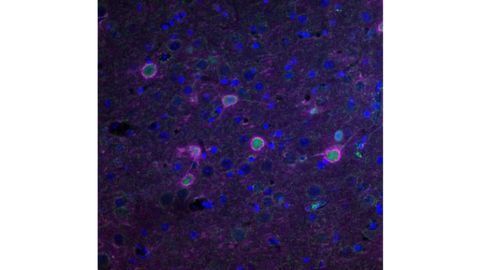 ALS Onset Successfully Delayed in Mouse Model