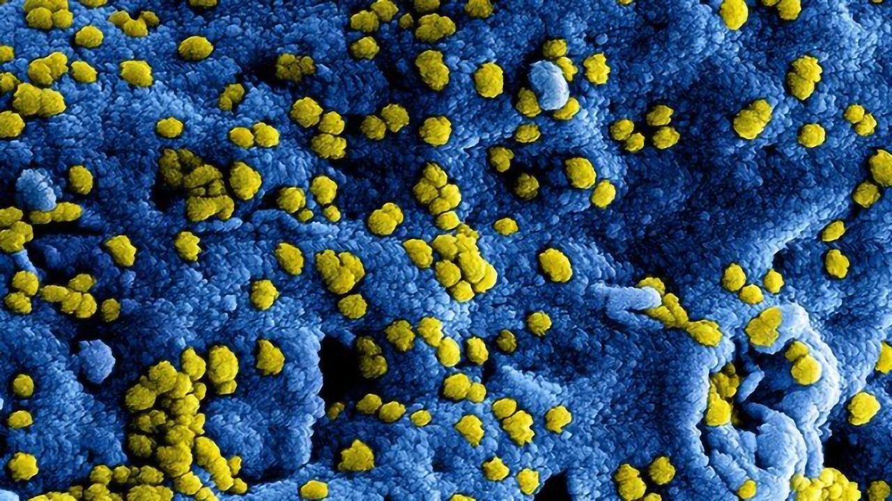 MERS Vaccine Clinical Trial Offers Useful Insights for SARS-CoV-2 Vaccine Development