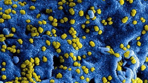 MERS Vaccine Clinical Trial Offers Useful Insights for SARS-CoV-2 Vaccine Development