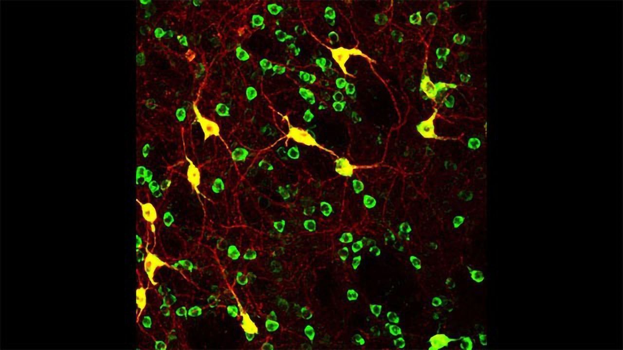 Striatal Cholinergic Interneurons