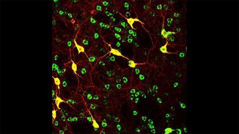 Striatal Cholinergic Interneurons
