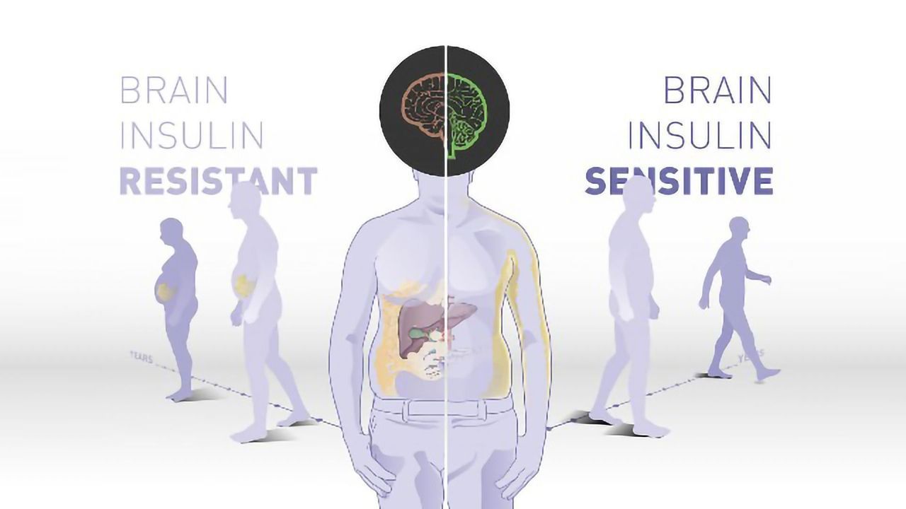 The Brain's Insulin Sensitivity May Play a Role in Weight Loss