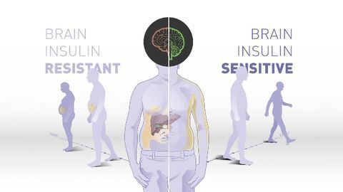 The Brain's Insulin Sensitivity May Play a Role in Weight Loss
