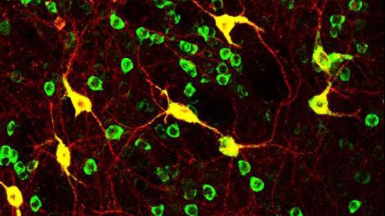 Dopamine Receptor Identified in Cocaine Addiction Pathways