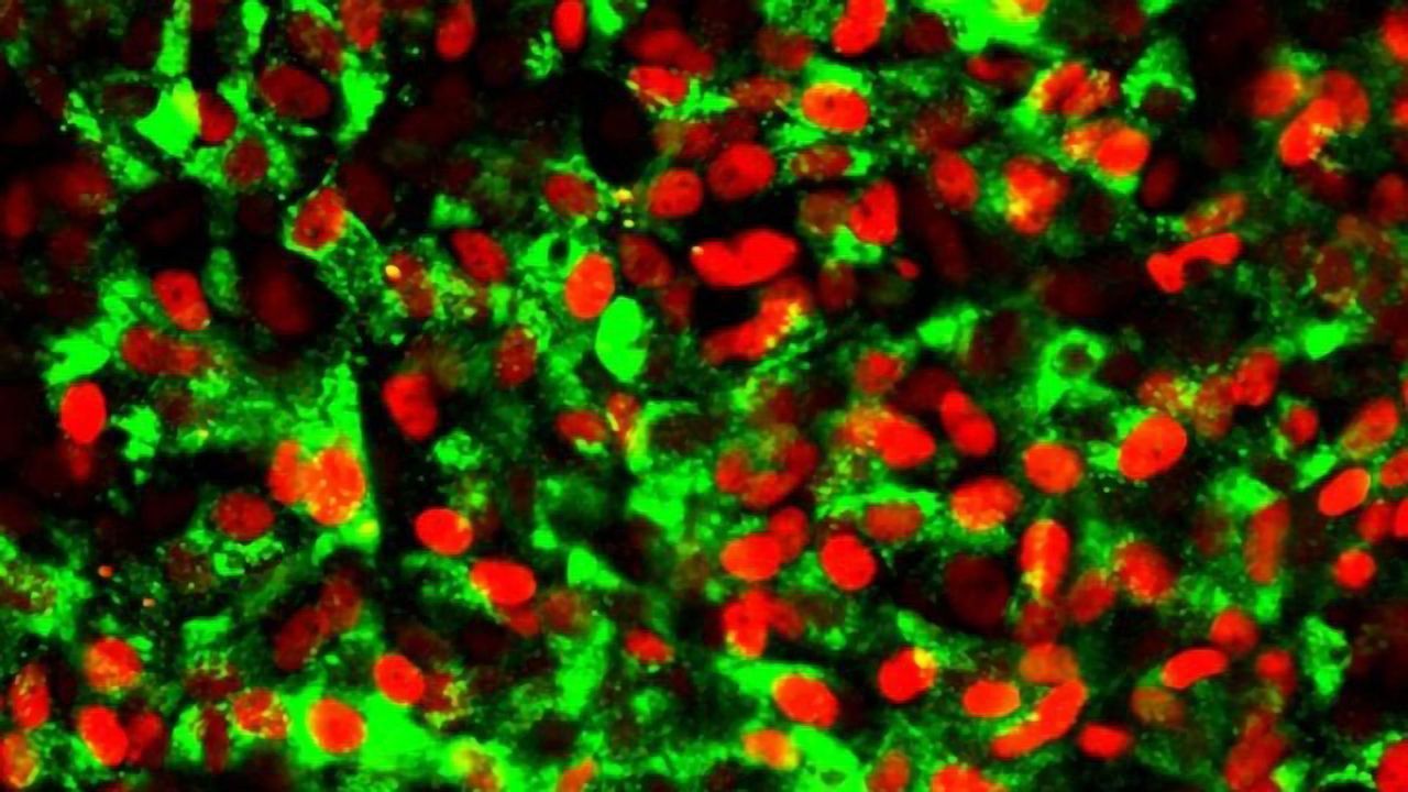 Beta Cells From Stem Cells