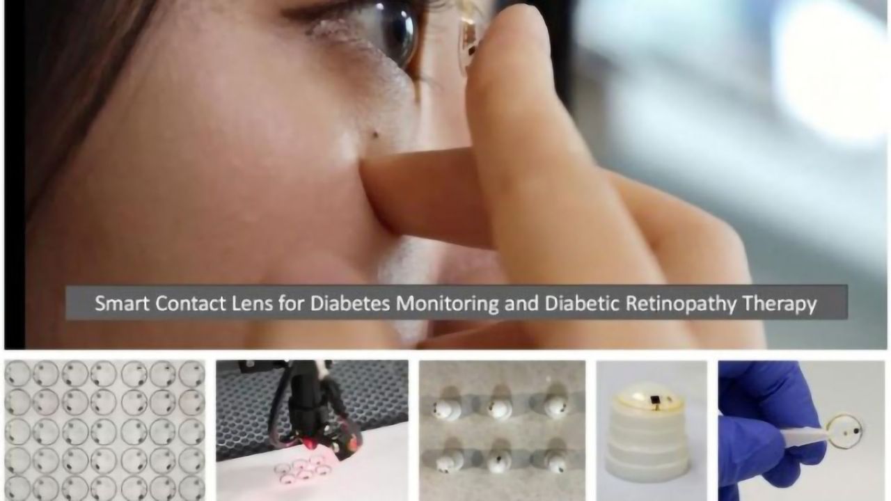 Smart Contact Lenses for Diabetes Monitoring