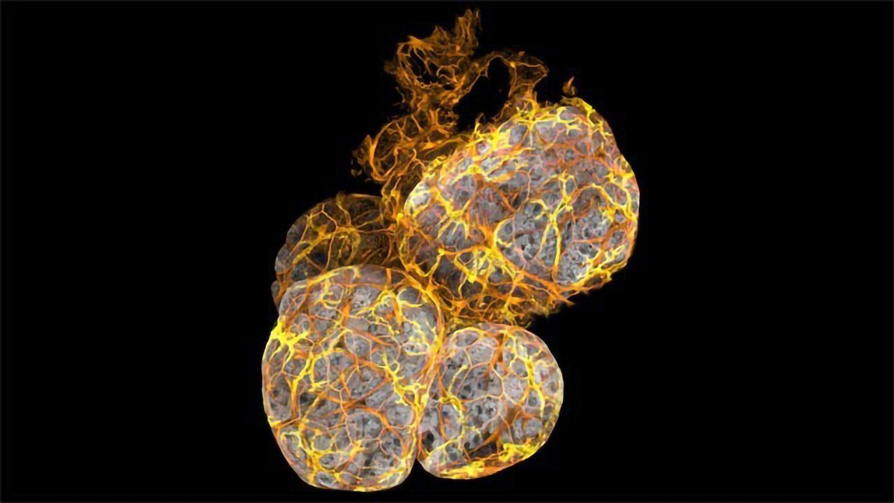 Mammary Gland Involution