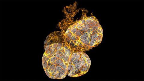 Mammary Gland Involution