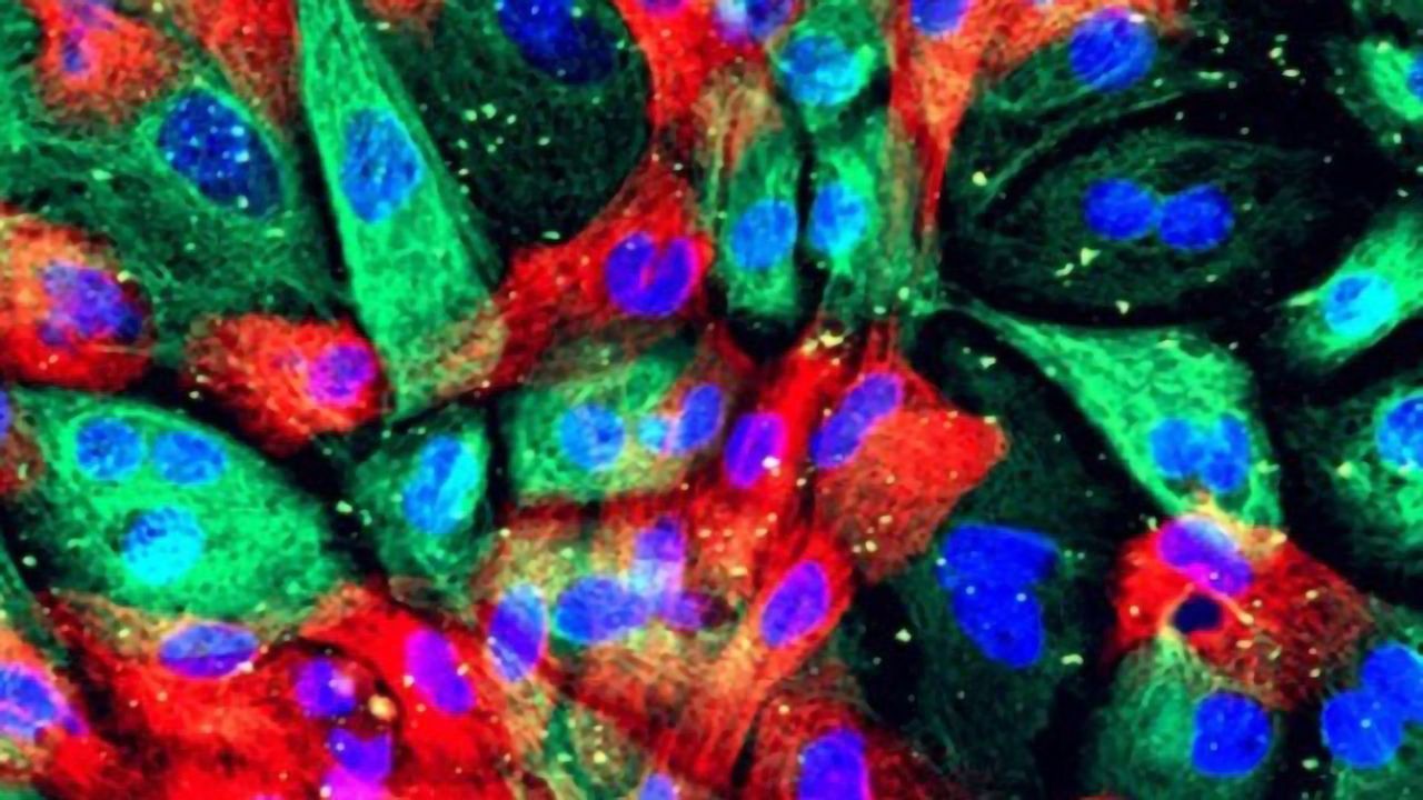 Trial Shows Breast Cancer Drug Can Keep Advanced Prostate Cancer in Check