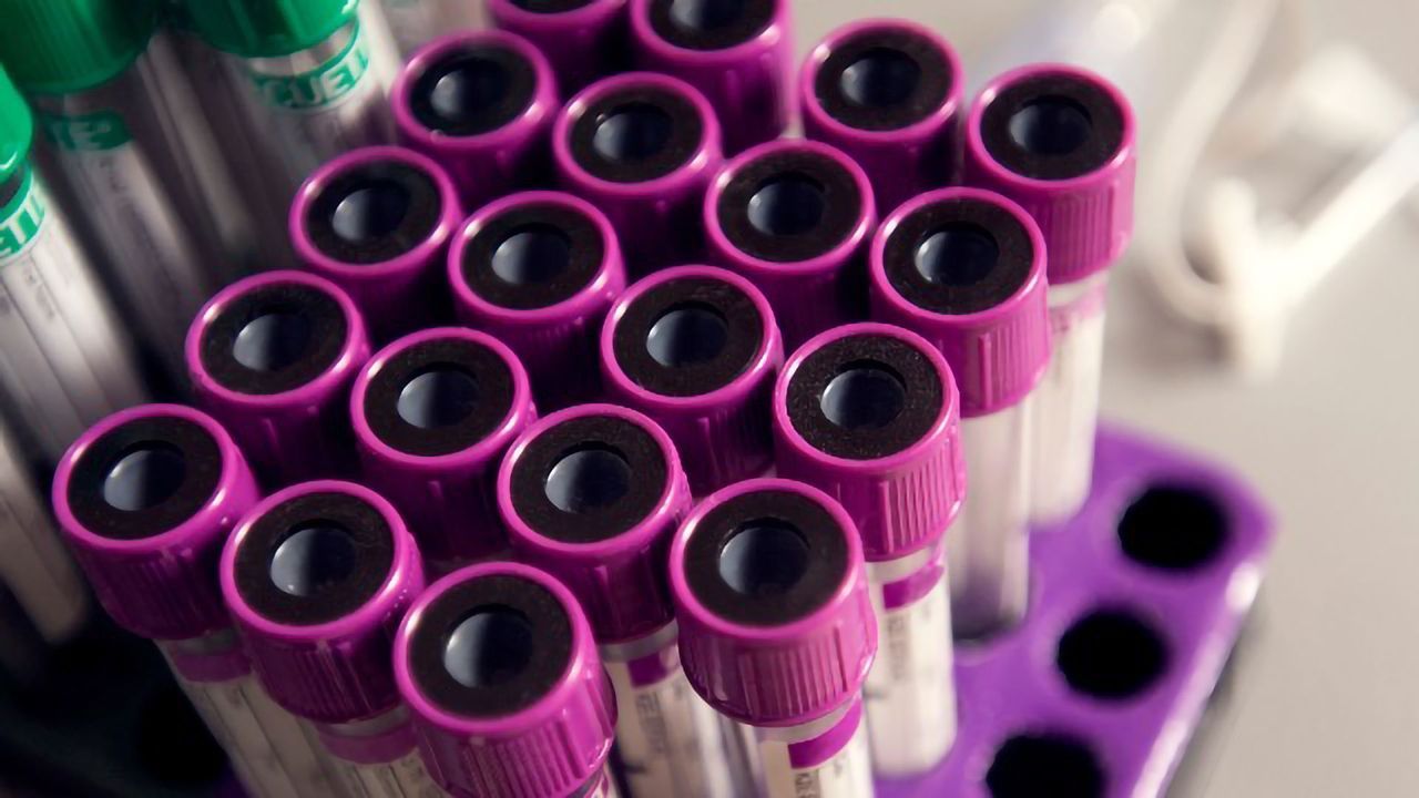 Sample Pooling Can Massively Increase Coronavirus Testing Capacity