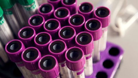 Sample Pooling Can Massively Increase Coronavirus Testing Capacity