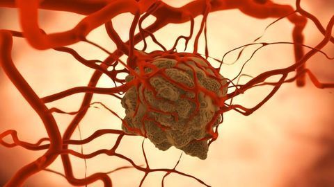 Cytokine-secreting “Backpacks” Boost Immune Cells’ Ability To Kill Cancer