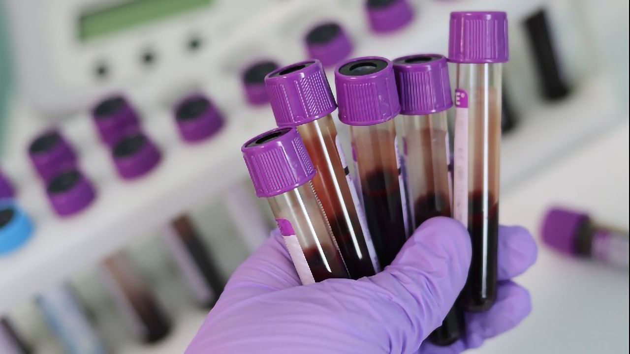 Scaling Up CRISPR-based Diagnostics